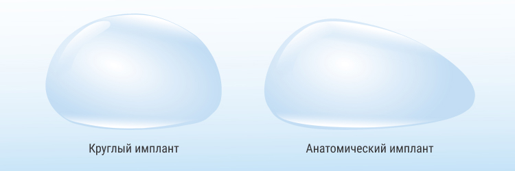 Круглый имплант (слева) и анатомический имплант (справа)